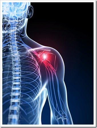 Shoulder Pain Fargo ND Rotator Cuff Syndrome