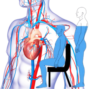 Postural Orthostatic Tachycardia Syndrome (POTS)